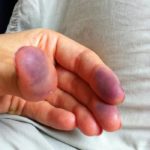 photo-11