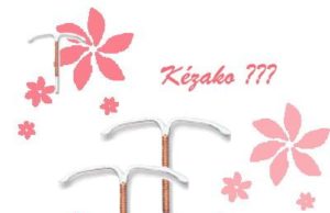 Bye Bye pilule contraceptive, Bonjour stérilet en cuivre ?